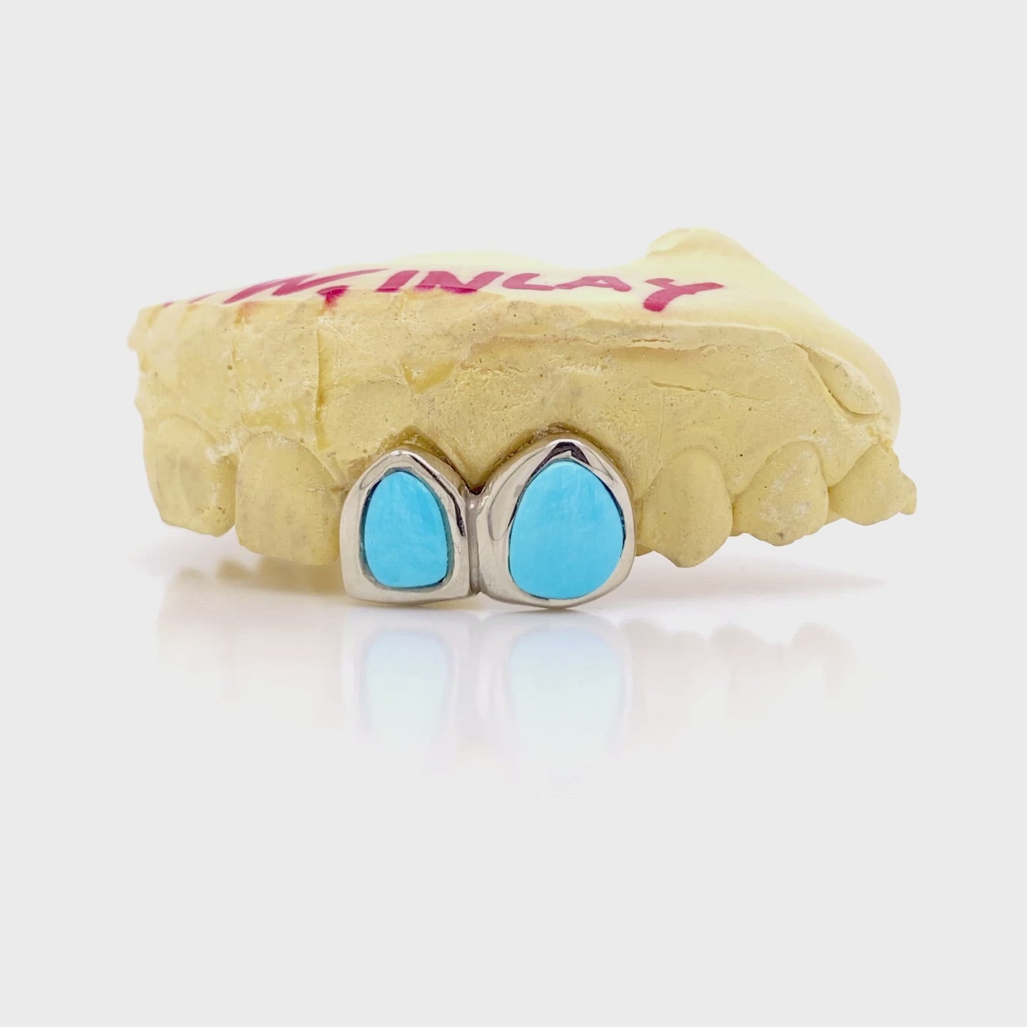 Turquoise Gold Grillz
